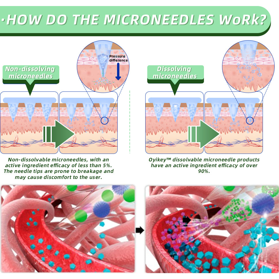 See results in 7 days🌲LOVILDS™ SMGT-GLP-1 Nano Microneedle Patch(Painless, long-lasting, addressing diabetes, obesity, and cardiovascular diseases)