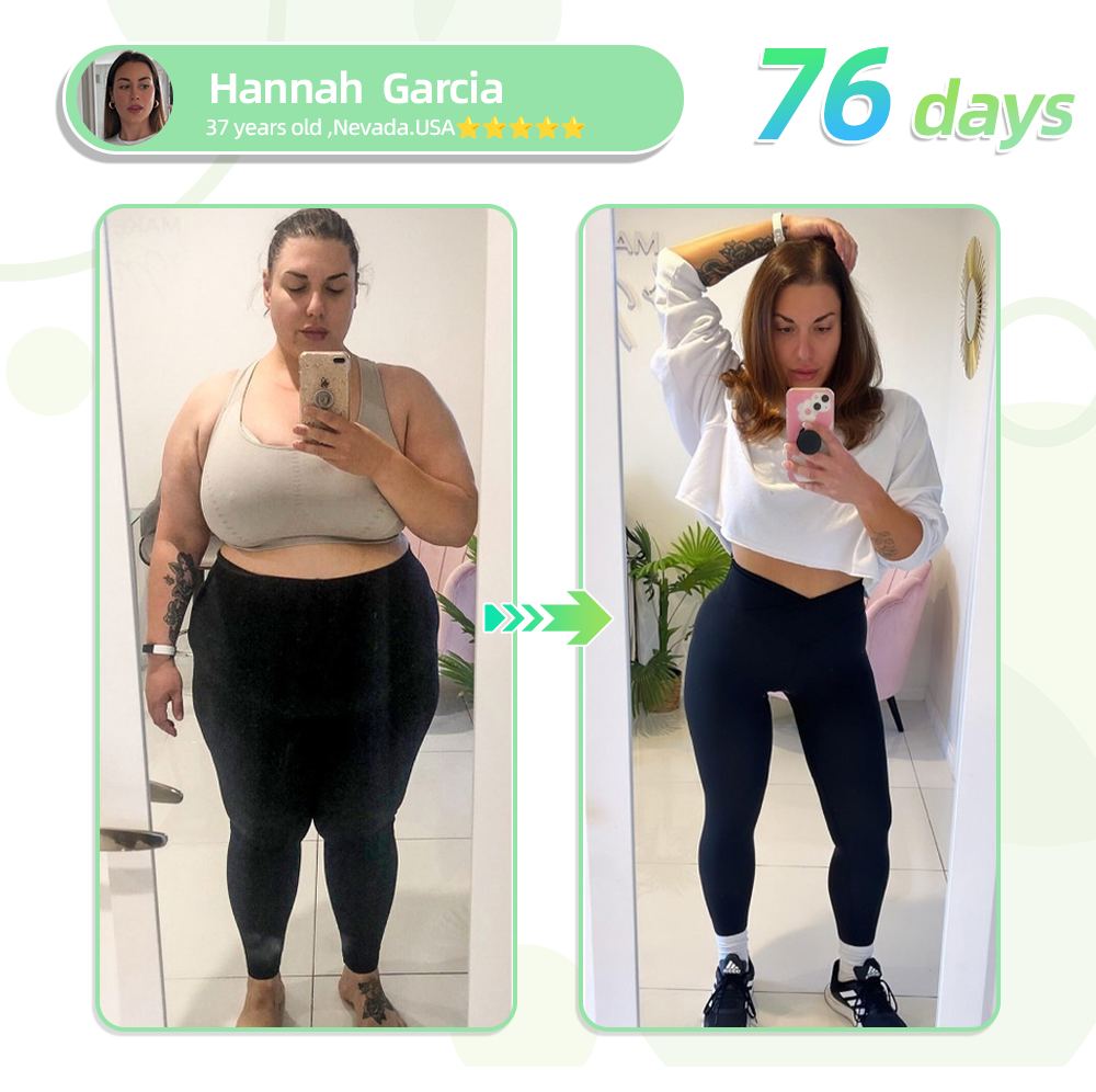 See results in 7 days🌲LOVILDS™ SMGT-GLP-1 Nano Microneedle Patch(Painless, long-lasting, addressing diabetes, obesity, and cardiovascular diseases)