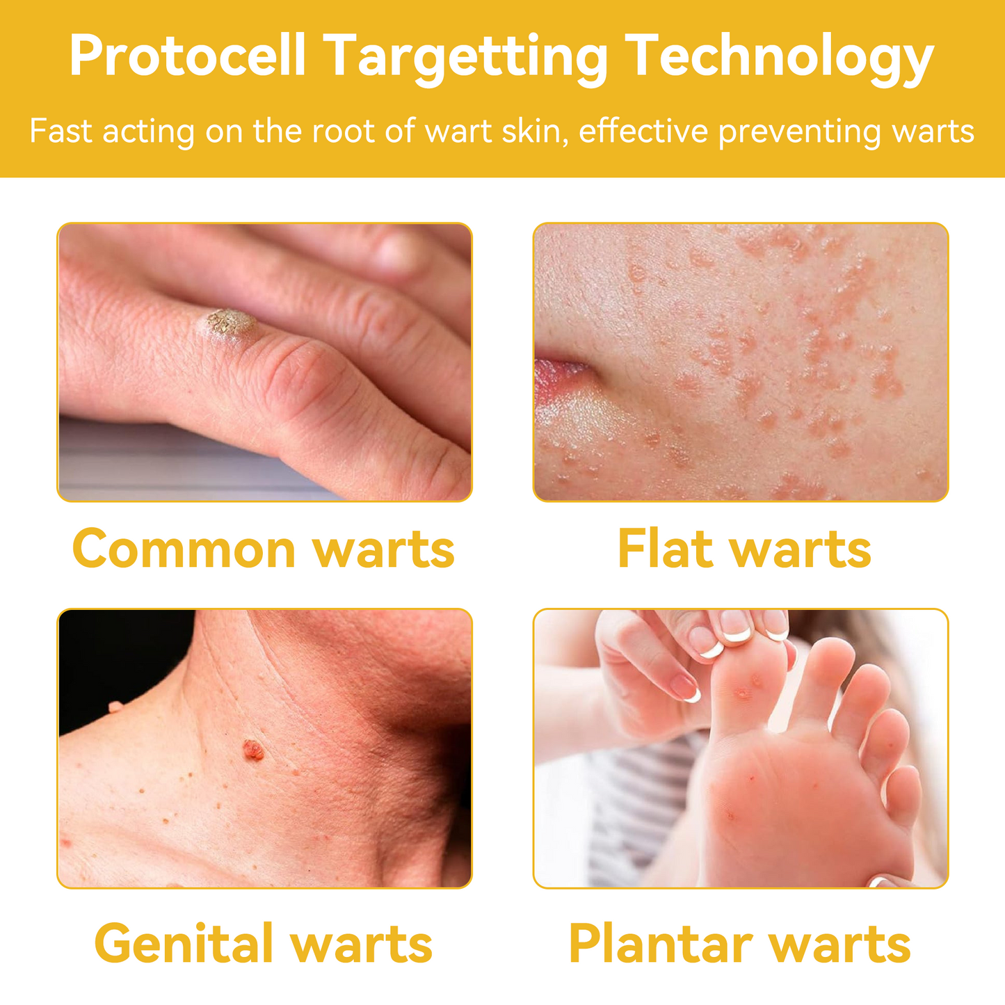 Histone™ Bee Poison Skin Treatment Cream (AAD Recommended)