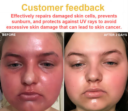 NESLEMY™ Bee Poison Skin Cream（👨‍⚕AAD Recommended),for Remove Warts, Acne and Scars