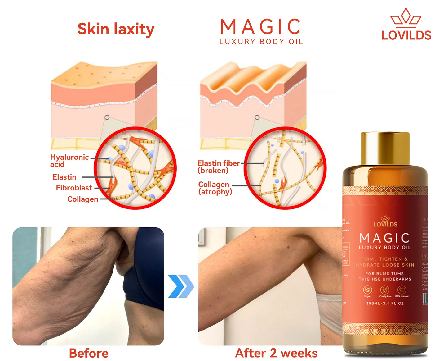 LOVILDS™ 𝗠𝗔𝗚𝗜𝗖 𝗟𝗨𝗫𝗨𝗥𝗬 𝗕𝗢𝗗𝗬 𝗢𝗜𝗟 (Limited Time 80% Off - Last 30 Minutes)🌹🔥