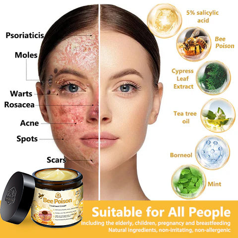 Histone™ Bee Poison Skin Treatment Cream (AAD Recommended)
