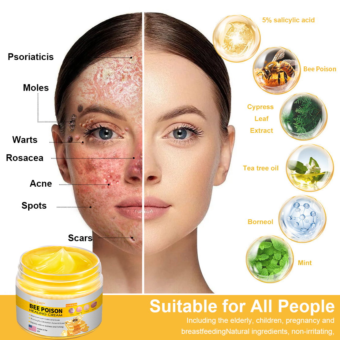NESLEMY™ Bee Poison Skin Cream（👨‍⚕AAD Recommended),for Remove Warts, Acne and Scars