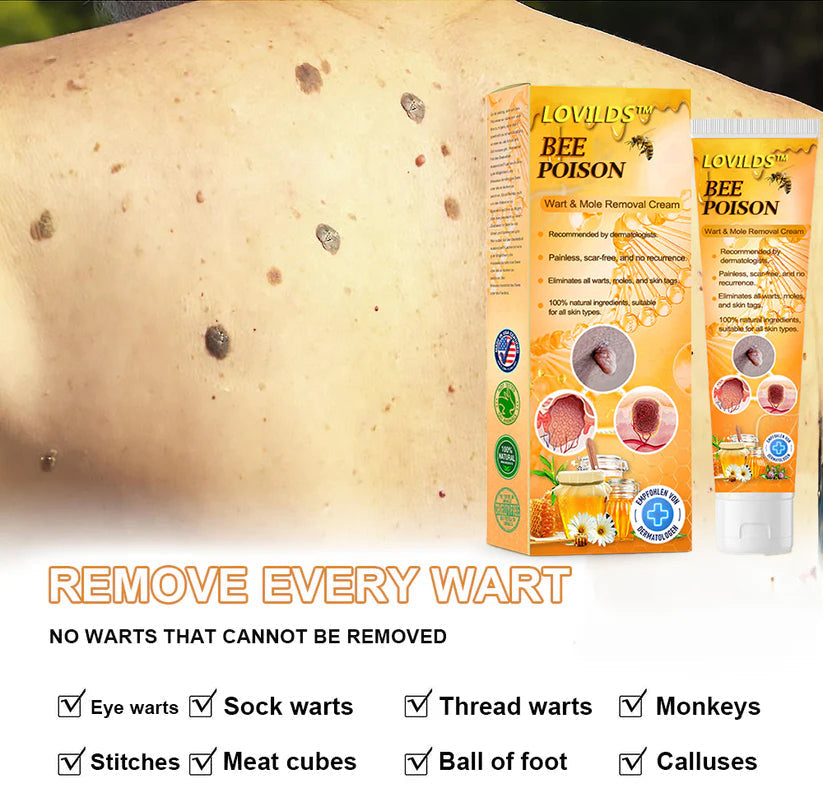 LOVILDS™ Bee Poison Wart & Tag Removal Cream(👨‍⚕Suitable for all skin types)🐝
