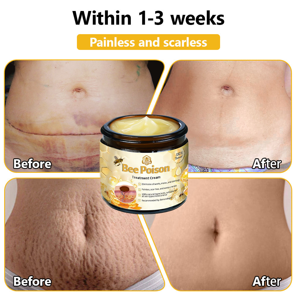 Histone™ Bee Poison Skin Treatment Cream (AAD Recommended)