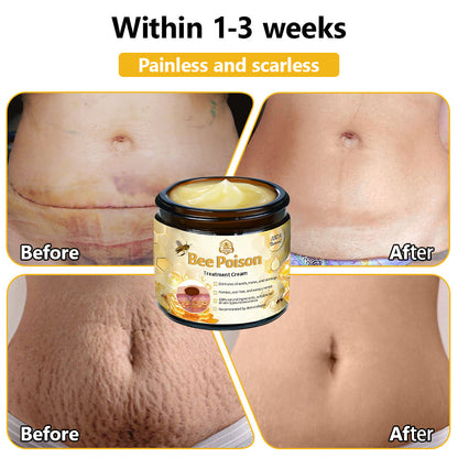 Histone™ Bee Poison Skin Treatment Cream (AAD Recommended)