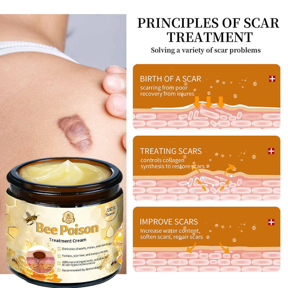 Histone™ Bee Poison Skin Treatment Cream (AAD Recommended)