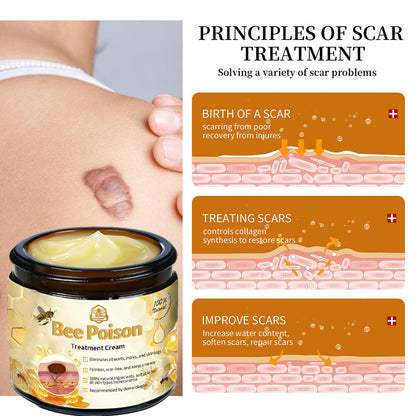 Histone™ Bee Poison Skin Treatment Cream (AAD Recommended)